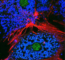 Immunofluorescence