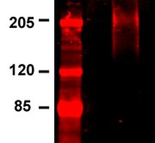 Immunoprecipitation